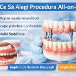 implant dentar în București